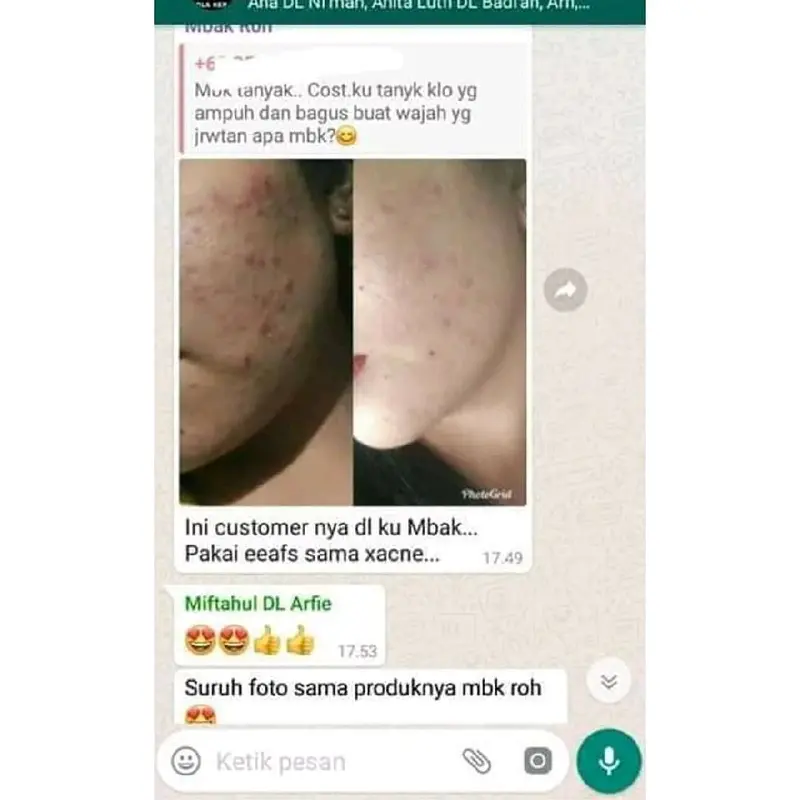 Sabun Wajah Erhsali Acne Soap Eaafs Original Nasa perawatan jerawat 8