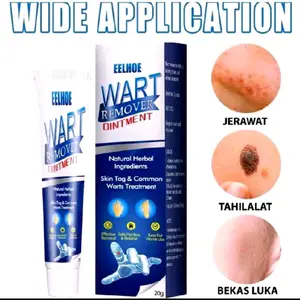 EELHOE Wart Remover Ointment - Obat Jerawat & Tahilalat Alami 20g untuk Perawatan Kulit