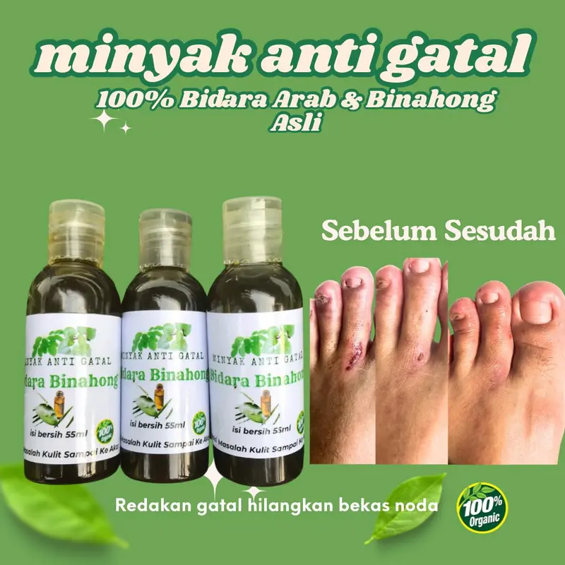 MINYAK URUT Bidara UNTUK GATAL EKSIM BISA DIPAKE  BADAN DAN WAJAH 0