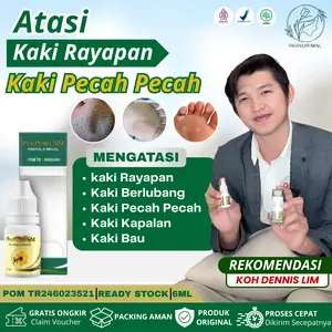 Propolis SM Obat Untuk Kaki Rayapan Kaki Bau  Kaki Kapalan Mata Ikan Isi 6ml
