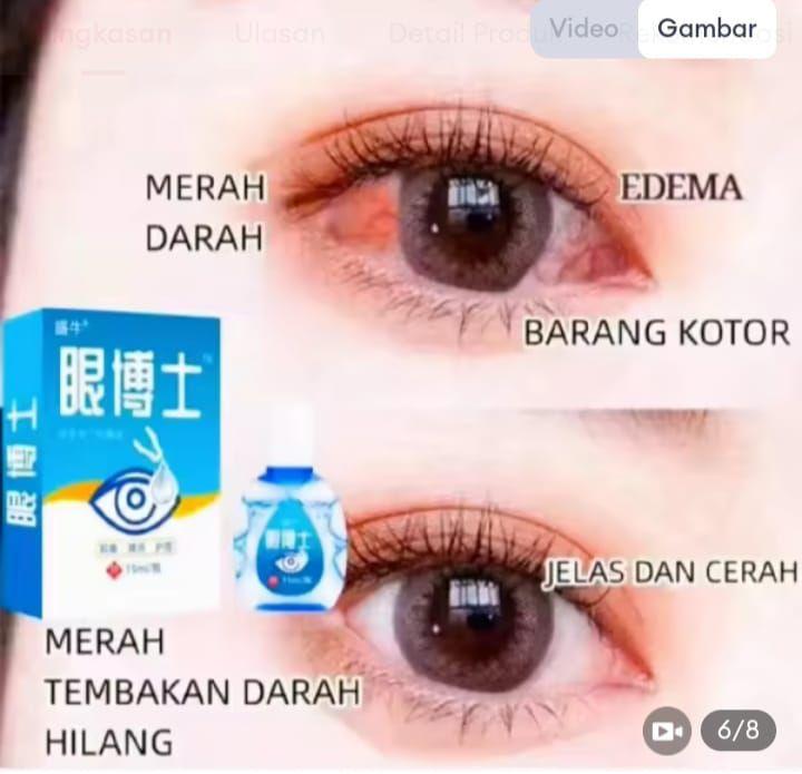 YEHUANGSU OBAT TETES MATA NO 1 JEPANG / TETES MATA JEPANG OBAT TETES MATA BERLEMAK KEKUNINGAN PTERIGIUM GLUKOMA MATA KATARAK