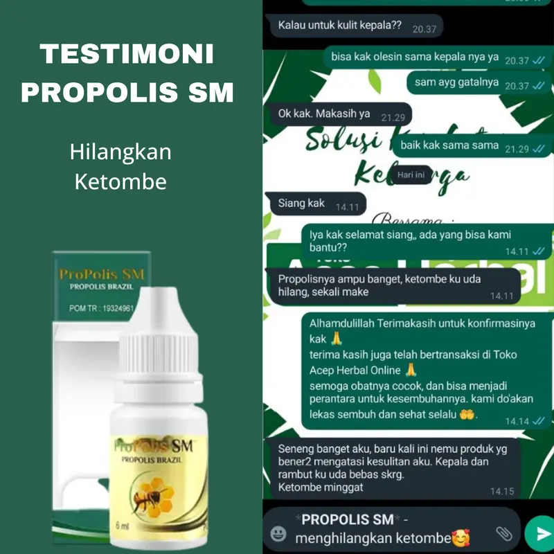 Propolis SM untuk Borok di Kepala, Kulit Kepala Berkerak dan Bersisik,  Gatal Kulit Kepala,  Ketombe ,  Jamur di Kepala,  Psoriasis Kulit Kepala 1