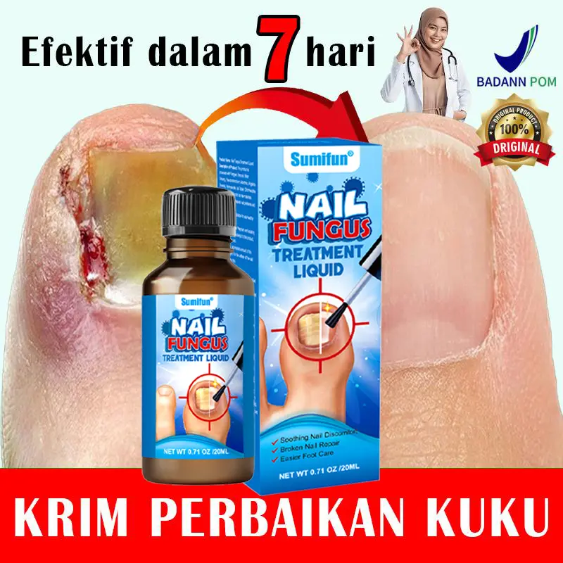 Krim pelembap tubuh Nail Repair Cream Original Kuku 20ML Perawatan Kuku Berjamur Serum Penghilang Jamur Di Kuku Vitamin Kuku Rusak Memperbaiki Kuku Rusak Sumifun Nail Repair Cream Salep Kuku Rusak, Kuku Berjamur