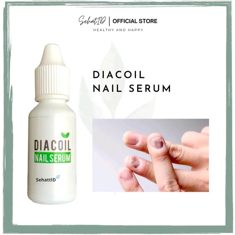 TETES KUKU CANTENGAN DIACOIL NAIL SERUM ATASI KUKU CANTENGAN 0
