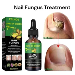 Obat Jamur Kuku Paling Ampuh 7 Day Nail Fungus Treatment Serum Anti Baklteri Obat Kuku Cantengan Serum Merawat Kuku dan Mengatasi Cantengan Bengkak Bernanah Menghitam