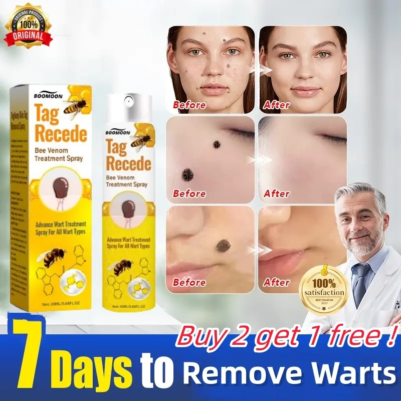 Tag Recede Bee Venom Spray Wart Remover Ubat Kutil Ketuat Skin - TikTok ...