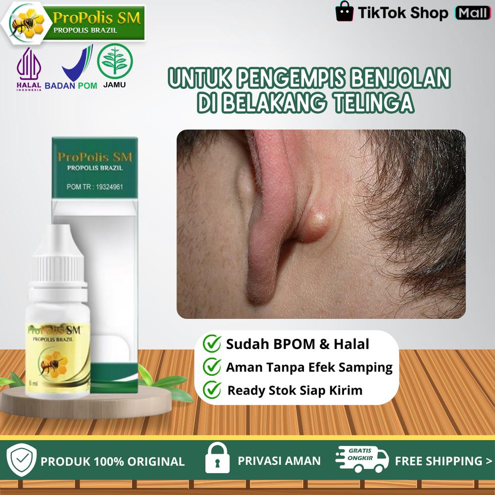 Propolis SM - Untuk Benjolan Di Belakang Telinga Anak / Mastoiditis, Benjolan Lipoma, Benjolan Karena Infeksi Radang Tenggorokan, Pilek / Flu Pada Anak