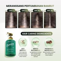 Gambar OSWEET Hair Revival Bundling | Ginger Shampoo + Tonic - Ginger 100ml + Tonic dari O'SWEET SINGAPORE Kab. Tangerang 2 Tokopedia