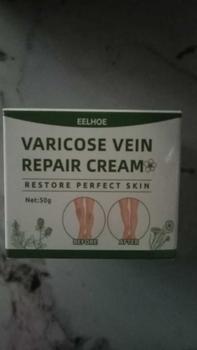 Product Review of krim penghilang vitiligo menghilanglan jamur panu dan mengatur pigmentasi kulit / vitiligo repair cream from V**o 0