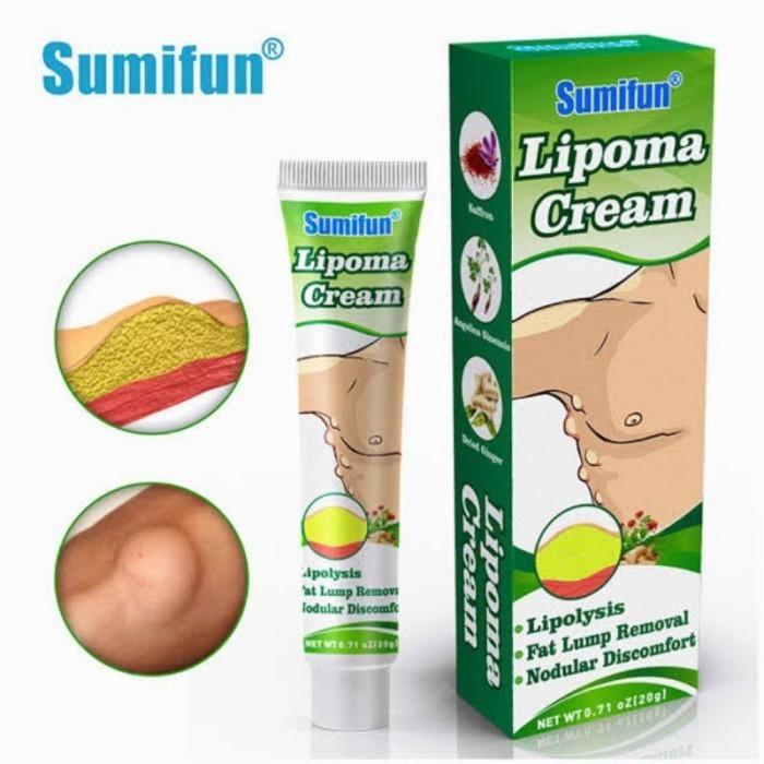 Product Introduction of sumifun lipoma solusi ampun menghilangkan benjolan 12