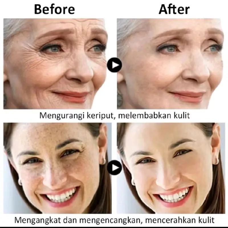 Essensi SERUM Ginseng Anti Kerut Serum Wajah 120ML - MEGATASI Kerutan DI WAJAH. Mengencangkan. Perawatan 5