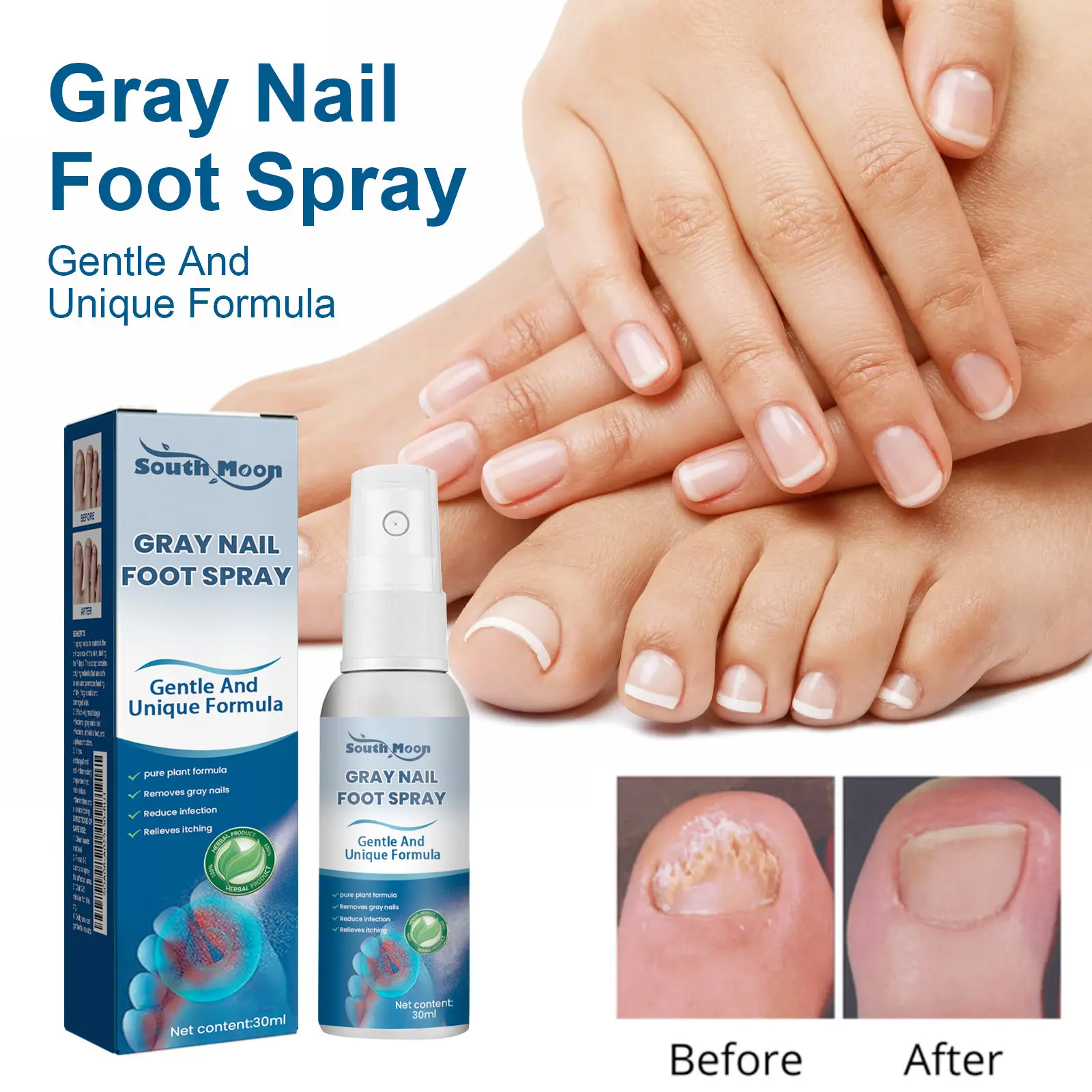 Gray Nail Repair Spray – 30ml Antifungal Treatment for Toenail Fungus & Odor Control, Moisturizing Nail Care with Natural Extracts, 3-Year Shelf Life
