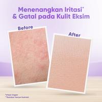 Gambar Cussons Baby Sensicare Moisturizing Lotion  - Losion Pelembab 200ml - Cussons Baby, Standar dari CussonsID Kota Administrasi Jakarta Barat 5 Tokopedia