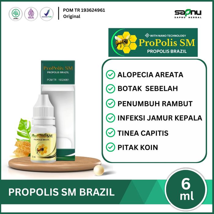 Gambar Propolis Sm Atasi Alopecia Areata, Oles Penumbuh Rambut Rontok, Infeksi Jamur Kepala dari SAPNU HERBAL INDO Kota Administrasi Jakarta Barat Tokopedia