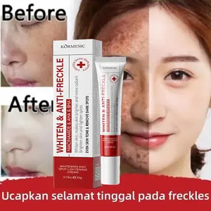 Krim penghilang flek hitam Krim pemutih wajah Krim bintik pemutih Krim penghilang flek 20G Hapus Flek Hitam Krim Anti Flek Niacinamide Memudarkan Pigmentasi Melasma Mencerahkan Krim concealer