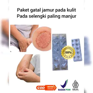 Suplemen kesehatan manjur untuk berbagai gatal jamur yang membandel pada kulit pada selengki untuk dewasa