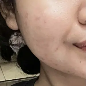 [BPOM]  Glad2Glow  Sensitive Care Micellar Water 300ml Tremella Panthenol Untuk Kulit Sensitif Pembersih Wajah Make Up Remover Cleansing Water dan Melembabkan Wajah