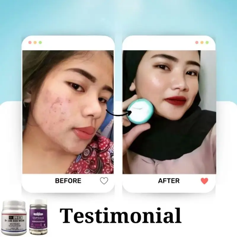 DR LSW + platinum whitening UNGU pemutih badan ampuh glumony kapsul collagen  Memutihkan badan dalam waktu singlat 4