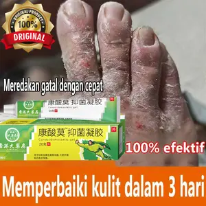Cream Gatal RACIKAN Paling Ampuh Cream Gatal Kulit Eksim Cream Anti Jamur  Kadas Kulit Ampuh Cream Jamur Kurap Alergi Kulit Psoriasis Eksim Kri