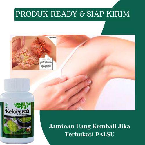 Suplemen Untuk Kanker Payudara, Tumor Payudara, Benjolan Payudara, Sakit Payudara, Carcinoma Mammae, Payudara Bengkak, Penghilang Benjolan Di Payudara, Pereda Sakit Payudara Dengan Keloreena 0