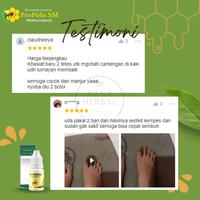 Gambar Obat Tetes Kuku Cantengan Terbukti 100% Kuku Cantengan Jempol Kaki dari Ridwan Herbal_NEW Kota Administrasi Jakarta Barat 2 Tokopedia