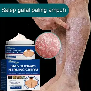 Salep gatal Salep Eksim Salep kulit Krim psoriasis paling ampuh Kulit Kepala Psoriasis Tangan Tinea Kaki Bau Versicolor Menghambat Dermatitis Jamur Anti Gatal Cream 20G