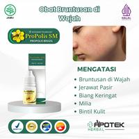 Gambar Propolis SM untuk Atasi Bruntusan di Wajah Jerawat Pasir Bekas Jerawat,  Perawatan Muka - Isi 6ml - 1 dari Apotek Herbal Kota Administrasi Jakarta Barat 1 Tokopedia