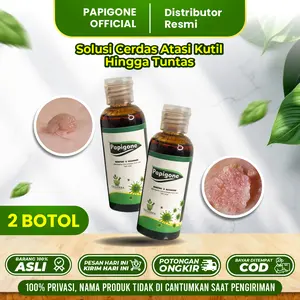 PAPIGONE Cairan Alami untuk Menghilangkan Kutil & Gatal di Kalamin - 2 Botol - Solusi Praktis & Aman - Halal & BPOM