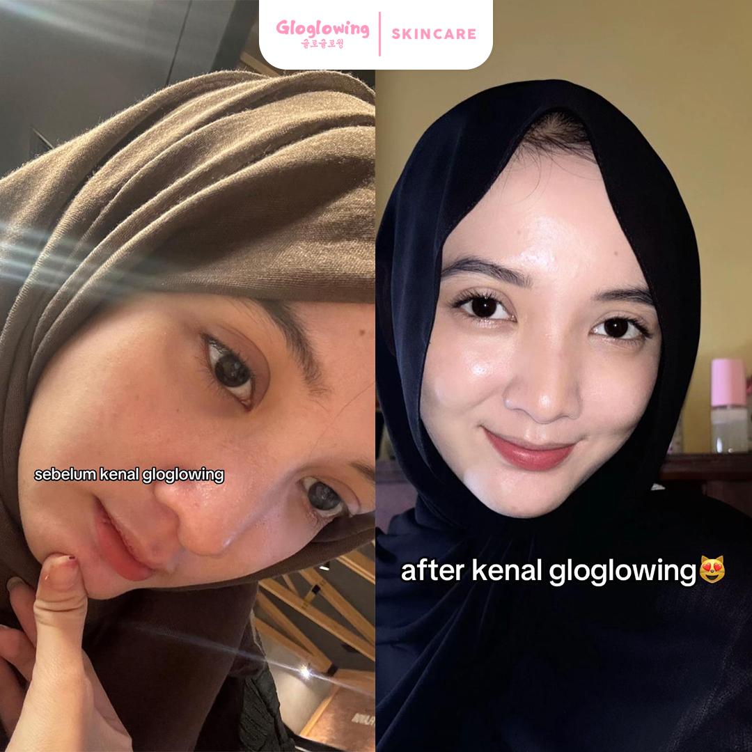 [HLIVE] DOSIS 1 - Paket Kinclong Booster White Truffle