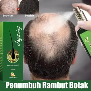 Semprotan Perawatan Rambut Terlaris! Memberikan Kilau Alami pada Rambut, Pijat selama 3 Menit, Menutrisi Sepanjang Hari! Solusi Perawatan Kulit Kepala, Semakin Banyak Anda Menggunakannya, Semakin Bervolume Jadi