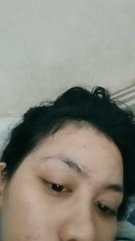 Product Review of Glow & Clear Layering -  Licorice Mefree +  Centella Mefree (Brightening Serum +  Acne Serum) - Mencerahkan sekaligus mengurangi jerawat, minyak berlebih, komedo dan chicken skin from N**3 0