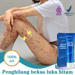Penghilang bekas luka hitam koreng salep penghilang bekas luka obat penghilang bekas luka 30g Menghilangkan bekas luka koreng Penghilang bekas gigitan nyamuk bekas luka di kaki keloid bekas luka bakas dan stretch mark Bekas Luka Luka Jahitan Bekas