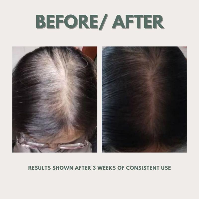 [MadeToBloom] Roots Revival Herbal Hair Growth Essence 3
