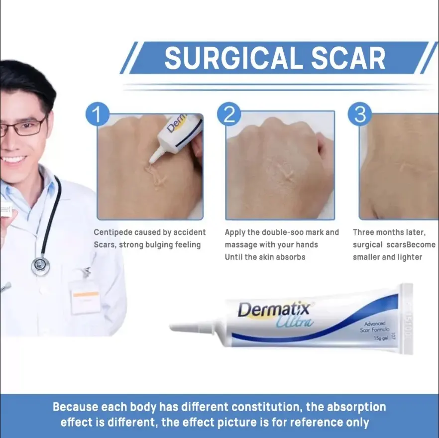 Dermatix ultra scar remover scar gel effectiv Treatment Scar 100% Australian original scar remover
