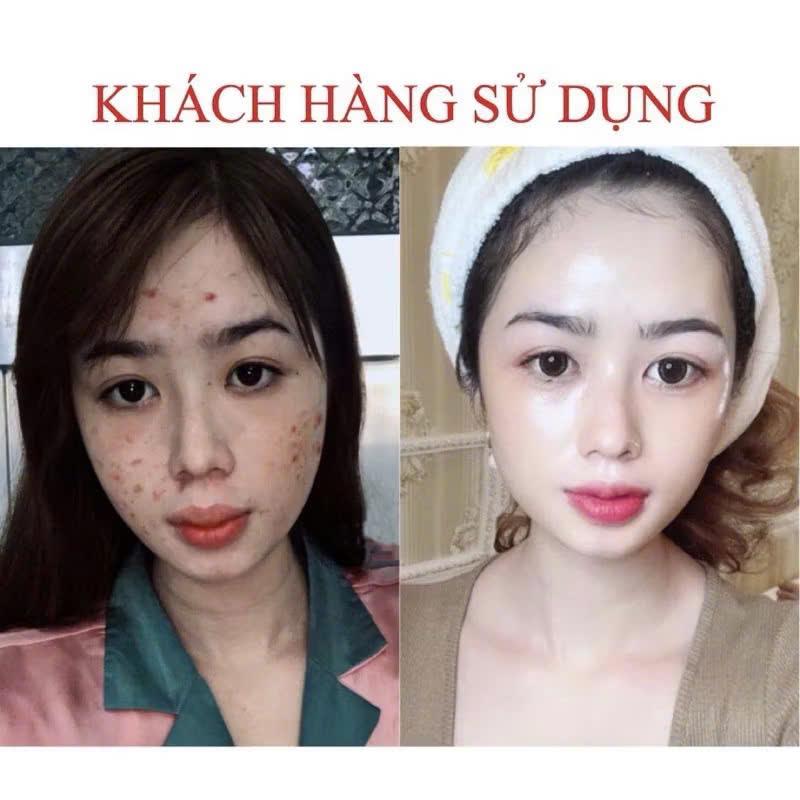 Serum giảm mụn thâm Seimy - Skin 7 Days Plus - 10ml.. 7