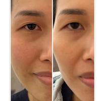 Gambar Pieras Propolinse Pretty Smile Line Mask Premium dari PIERAS PROPOLINSE Kota Administrasi Jakarta Selatan 5 Tokopedia