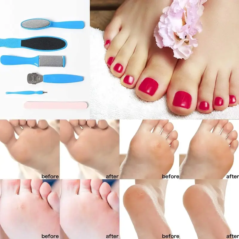 Bộ 8 Món Dụng Cụ Mài Gót Chân, Thiết Kế Hình Cá Bạch Tuộc Chân, Để Tẩy Tế Bào Chết, Giảm Vết Nứt Gót Chân, Loại Bỏ Gót Chân Nứt Nẻ, Dũa Loại Bỏ Vết Nứt Gót Chân, Cho Gót Chân Và Gót Chân 8