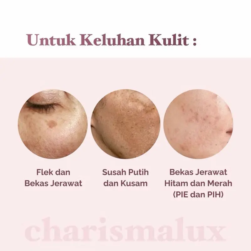 Paket Pemutih Wajah - Whitening Night Cream - Cream Pemutih Wajah - Day Cream Pemutih - Sunscreen Pemutih Wajah Cleanser 2