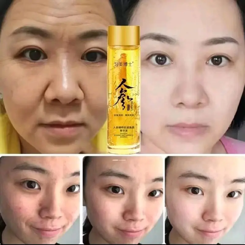 Essensi SERUM Ginseng Anti Kerut Serum Wajah 120ML - MEGATASI Kerutan DI WAJAH. Mengencangkan. Perawatan 4