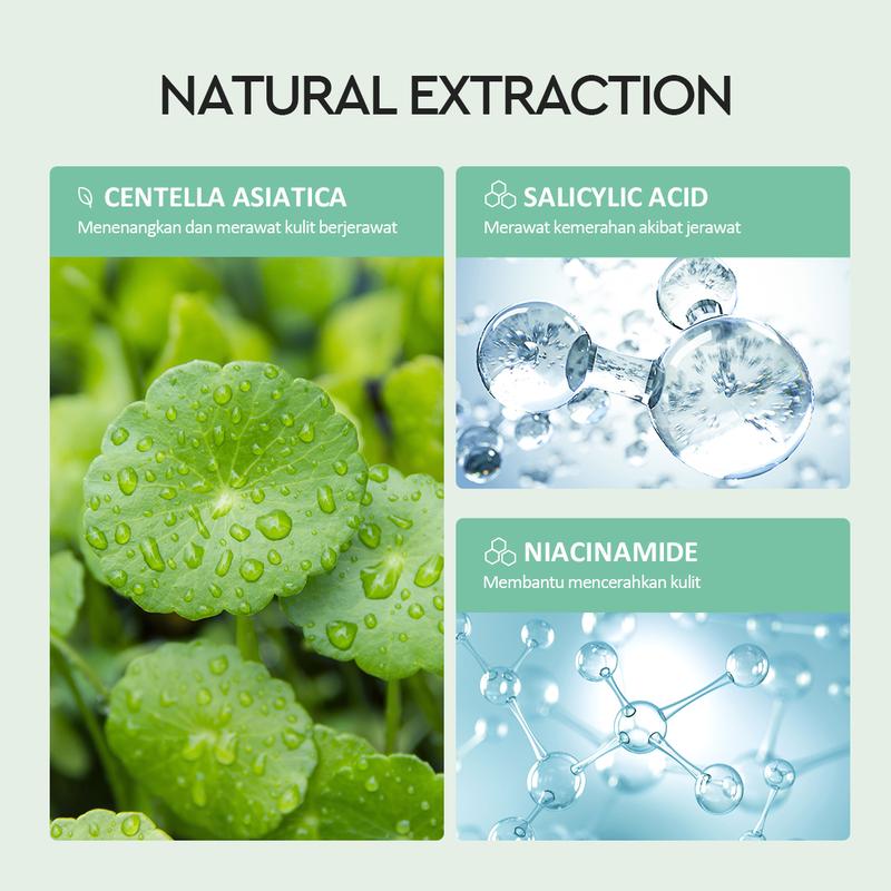 Glad2Glow Centella Salicylic Acid Overnight Acne Spot Treatment 5g | Totol Jerawat Salep Jerawat Acne Gel Anti Acne Cream 2