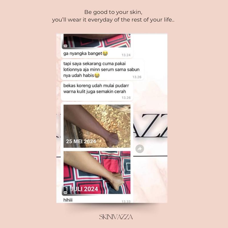 SKINIVAZZA - Black Caviar Whitening Intense Body Serum - 5% NIACINAMIDE 5