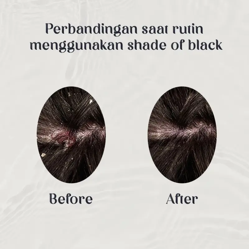 Hair Serum Shade Of Black | Menyehatkan kulit kepala dan merangsang pertumbuhan rambut 2