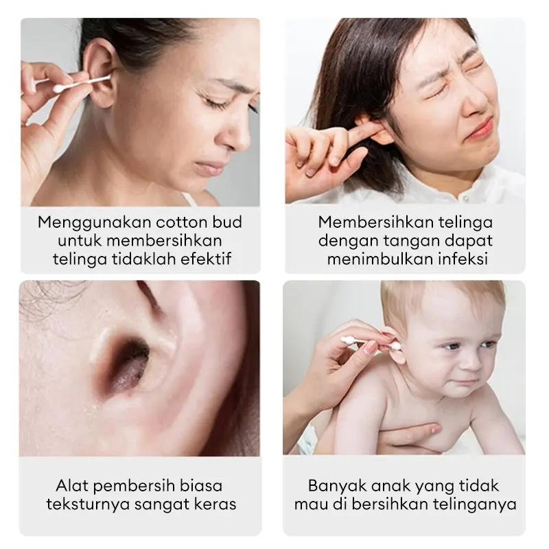 【Garansi 10 tahun】Korek kuping led Pembersih Telinga bayi alat pembersih telinga WIFI ear wax 5 in 1 Stainless steel besi earwax Senter  Dapat dihubungkan ke ponsel 1
