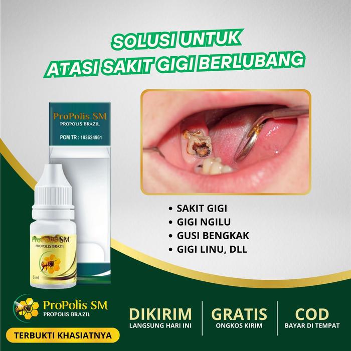 Gambar Sakit Gigi, Pereda Nyeri Sakit Gigi, Gusi Bengkak, Gigi Berlubang, Sakit Gusi Berlubang Agar Copot, Sakit Gigi Nyeri Gusi Nyut-Nyutan, Tetes Sakit Gigi Untuk Anak Dan Dewasa - Propolis SM dari Rino Herbal Shop Kota Administrasi Jakarta Barat Tokopedia