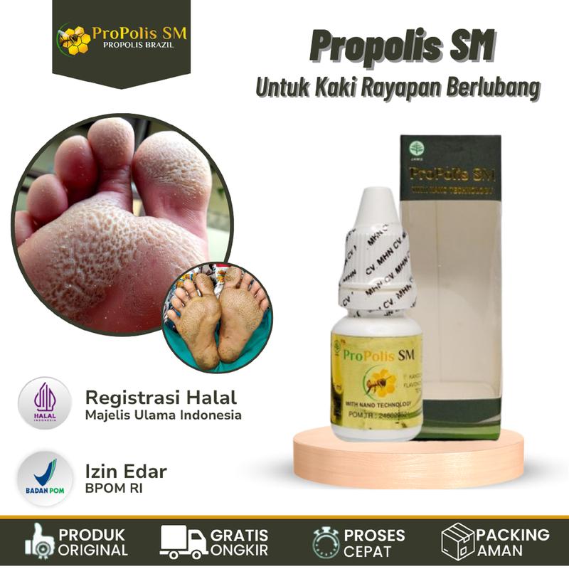 Cairan Penghalus Kaki Rayapan Telapak Kaki Bolong Berlubang Propolis SM Hand Tangan Perawatan Lotion 1