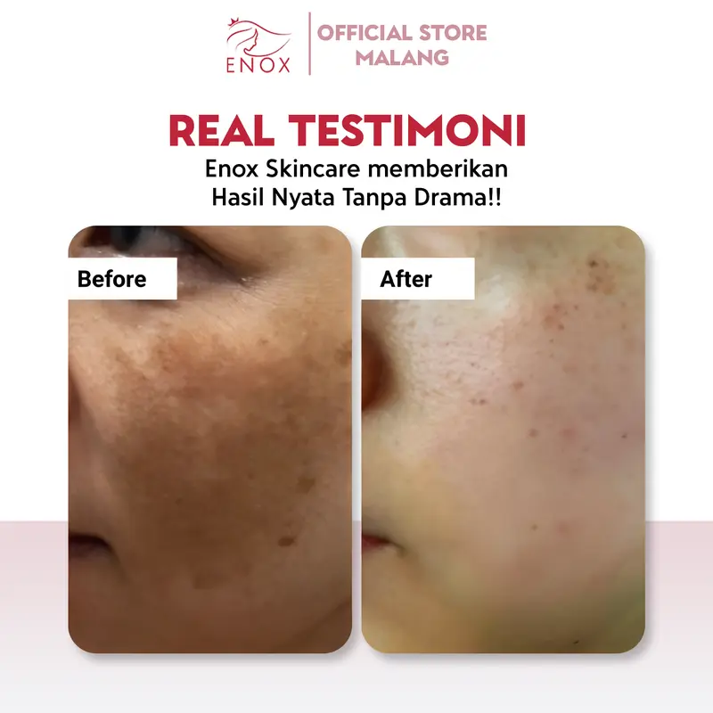 Enox Skincare - Brightening Glow Up Serum Anti Aging Mencerahkan Menyamarkan Kerutan dan Mengurangi Flek Hitam 3