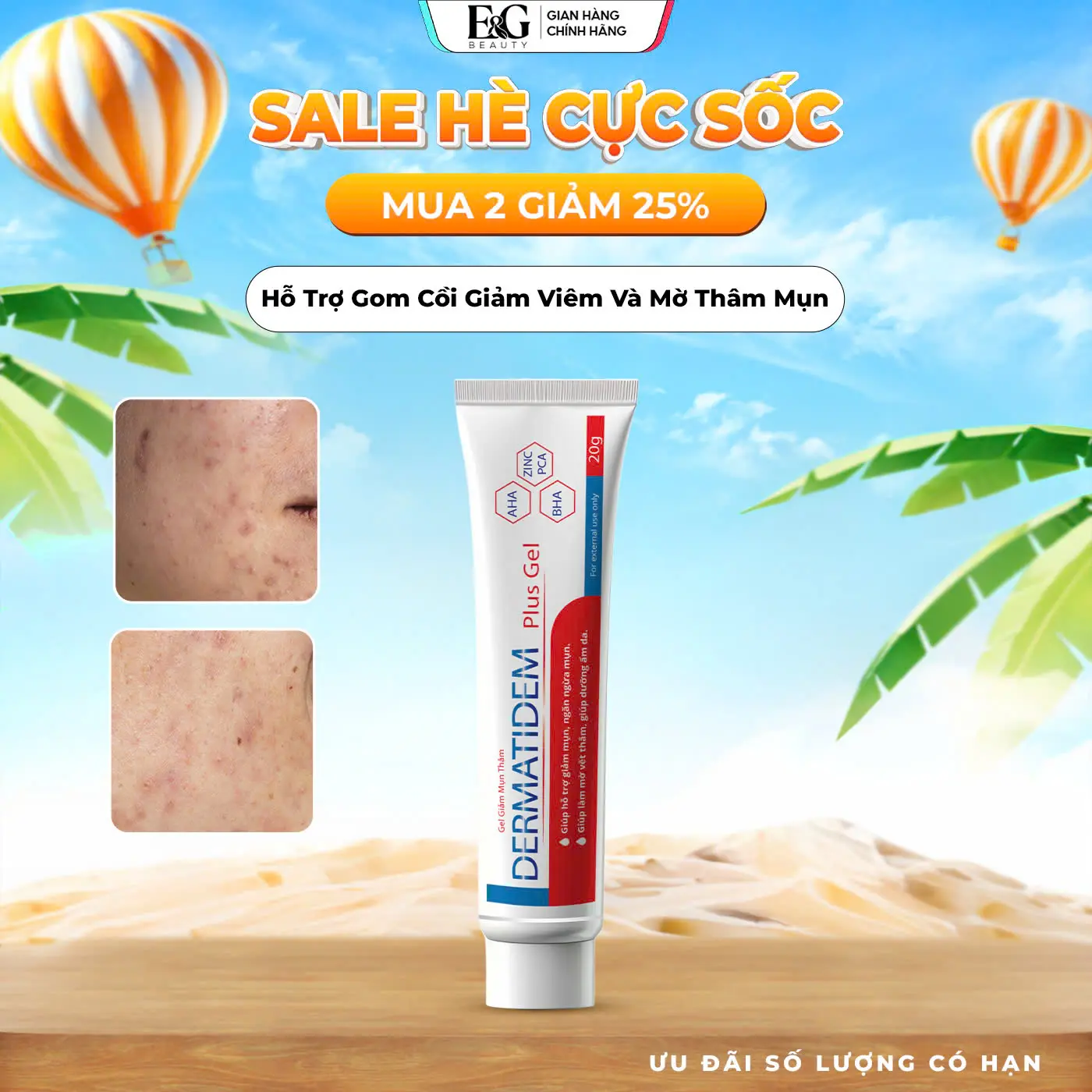[MUA 2 GIẢM 25%] Gel Chấm Mụn DERMATIDEM PLUS Hỗ Trợ Giảm Mụn Mờ Thâm E&G Beauty 20g - Giúp Giảm Mụn Viêm Mụn Ẩn Thâm Mụn Làm Đẹp Da Chăm Sóc Da Nữ Skincare Women