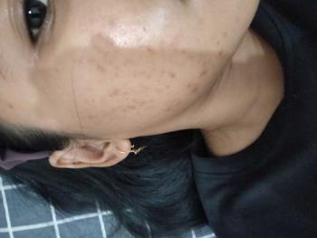 Product Review of [opy] DOSIS 2 - Paket Retinol Booster Cysteamine / Antioxidant from @**4 2