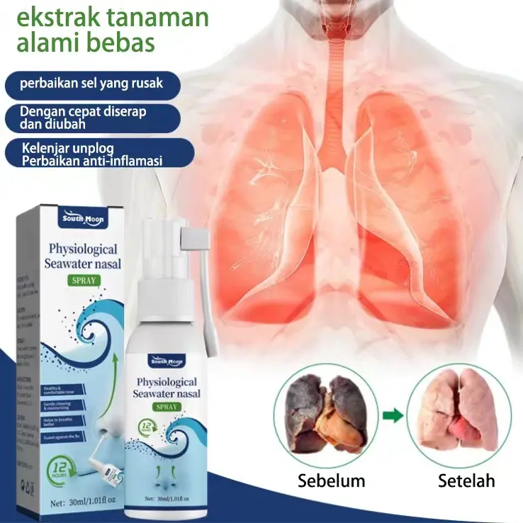 Nasal Spray Obat Sinusitis Spray Semprotan Hidung Untuk Membantu Meringankan Sinusitis Rhinitis Pilek Therapy Anosmia Dewasa Anak Bayi Anti Virus Dan Bakteri 4