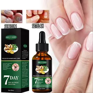 Obat Jamur Kuku 50ml Obat kuku jamur dan rusak Nail Repair Essence Serum Antibakteri Perawatan Kuku Onikomikosis Paronychia Anti Infeksi Kuku Toe Nail Pengobatan Jamur Minyak Esensial Antibacterial Nail Essential Oil